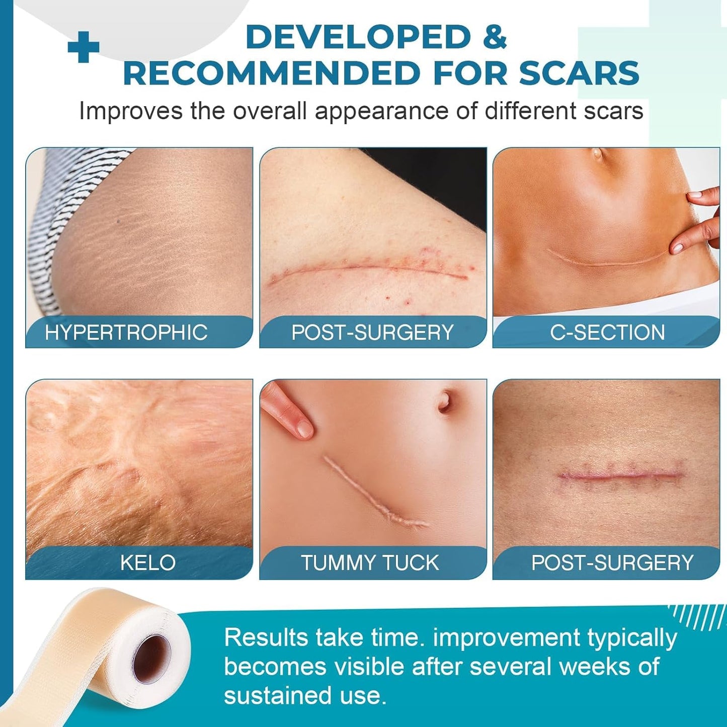 ScarMend™ - Renew Skin and Fade Scars